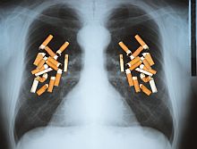 röntgenaufnahme von lungen, mit darauf ausgelegten zigarettenstummeln