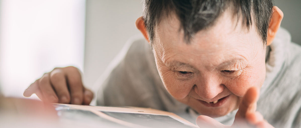 Alzheimer bei Down-Syndrom Lächelnde ältere Frau mit Down-Syndrom