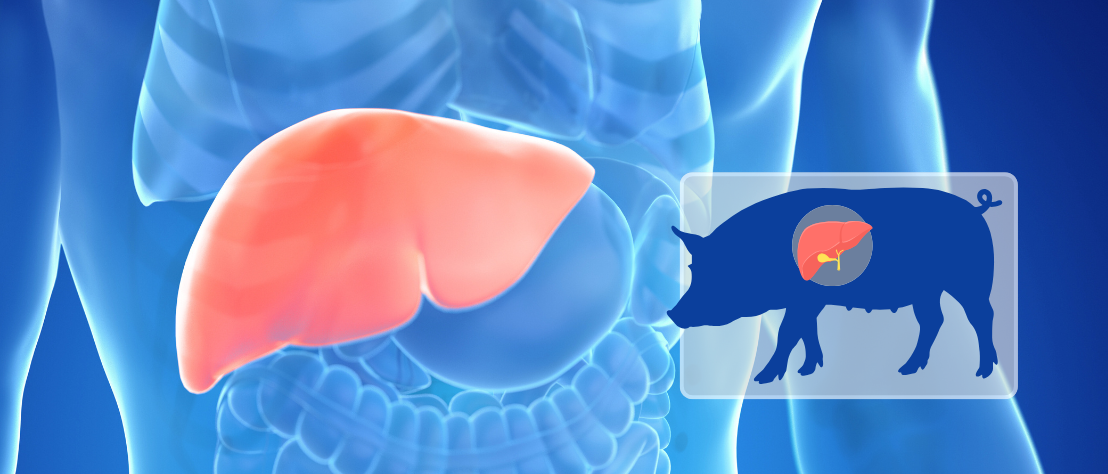 Transplantation einer Schweineleber Transplantation einer Schweineleber