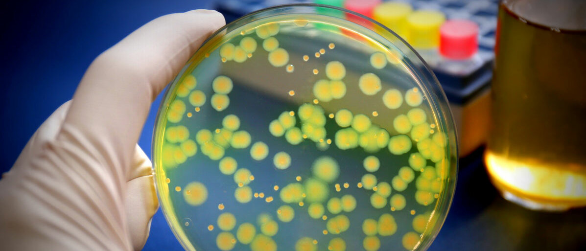 Bakterien auf einer Petrischale