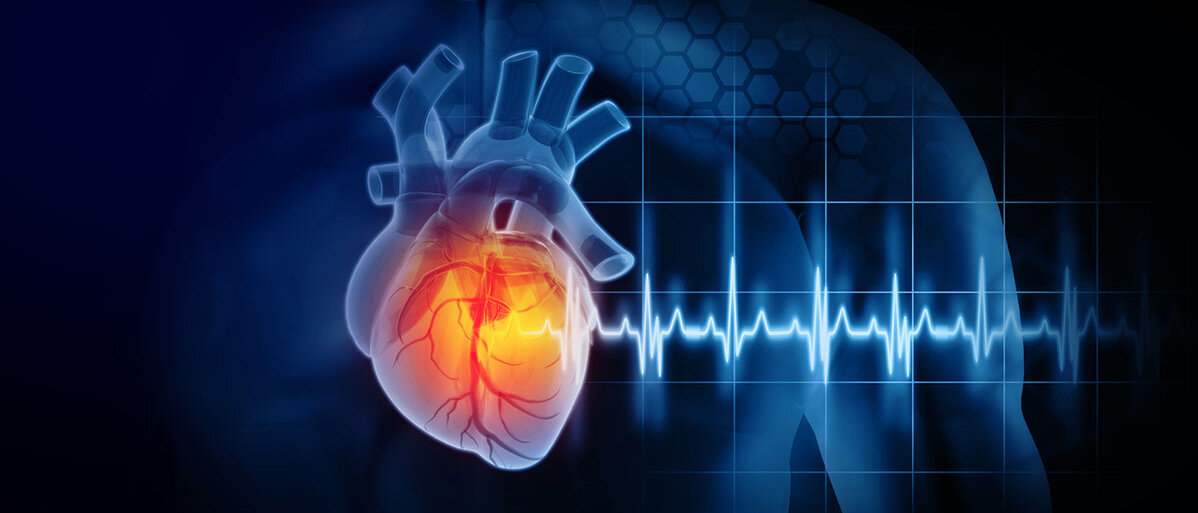 3D-Darstellung Herz und einem Herzinfarkt auf schwarzem Hintergrund