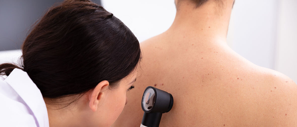 Hautaerztin untersucht Rücken von einem Patienten