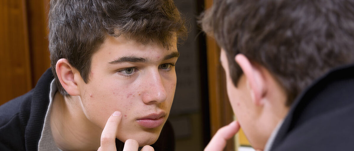 Jugendlicher schaut sich im Spiegel an und deutet mit Finger auf sein Gesicht