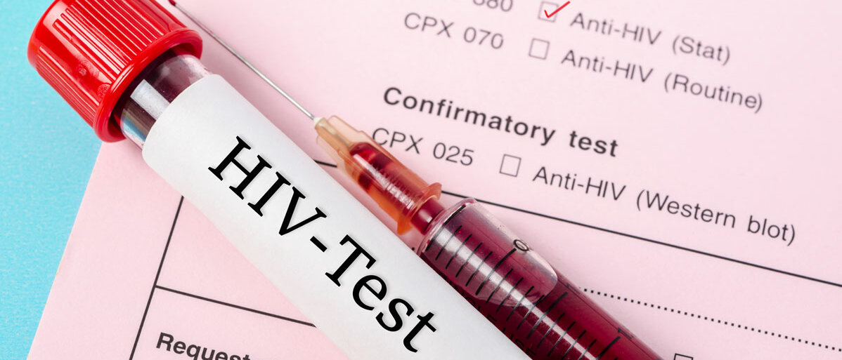 Auf einem Laborbogen ist unter verschiedenen Auswahlmöglichkeiten angekreuzt "Anti-HIV (Stat)", auf dem Bogen liegt ein Probenröhrchen und eine Spritze voll Blut, beschriftet mit "HIV-Test".