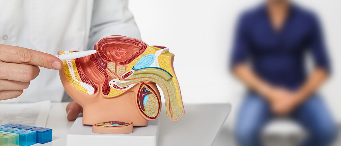 Arzt zeigt mit Stift auf ein anatomisches Modell der männlichen Fortpflanzungsorgane bei einer urologischen Beratung.