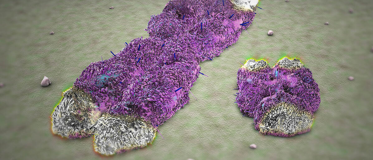 Was passiert, wenn das Y-Chromosom im Alter verschwindet Ein großes X-förmiges Chromosom und ein wesentlich kleineres Y-Chromosom