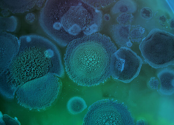 Resistenzen gegen andere Keime als Bakterien: So funktioniert die Resistenzbildung bei multiresistenten Erregern wie Pilzen, Viren und Parasiten. Aspergillus-fumigatus-Kultur in einer Petrischale: blau-grüner Pelz