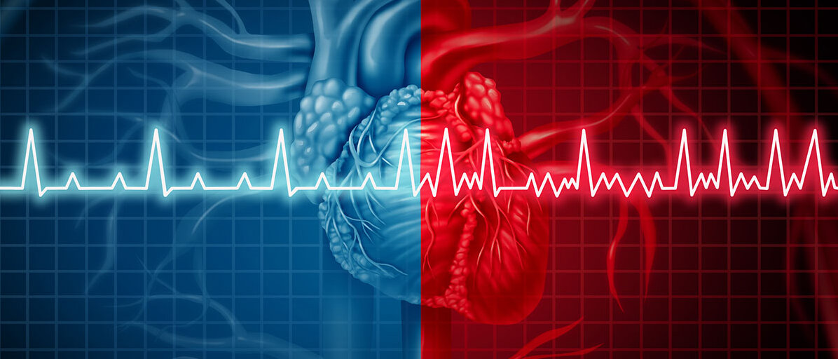 geteiltes Bild links blau und rechts rot darauf ist ein Herz zu sehen mit Vorhofflimmern