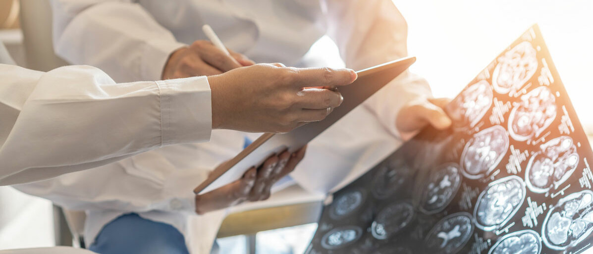 Ärzte halten MRT Aufnahmen vom Gehirn in der Hand