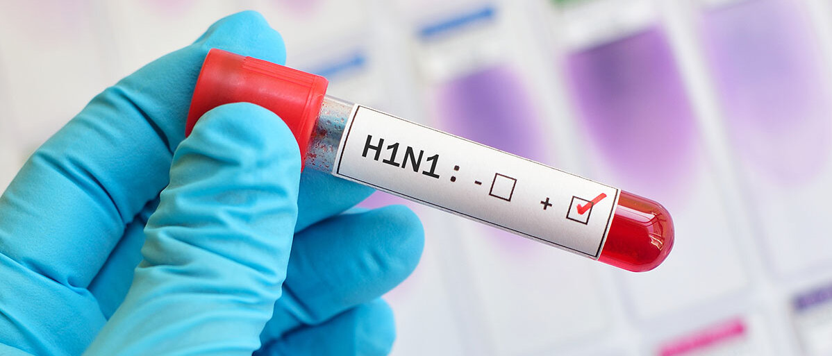 Eine behandschuhte Hand hält ein Proberöhrchen, das mit H1N1 beschriftet ist.