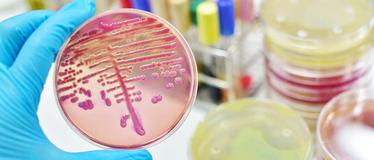 Ein neuer Nachweis von Bakterien im Blut kann bei einem Infekt die genaue Diagnose beschleunigen. Bakterienkultur in einer Petrischale; im Hintergrund liegen weitere Petrischalen und Blutproben für Antibiogramme.
