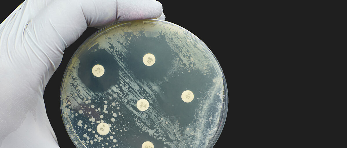 Eine Petrischale mit Bakterienkeimen und Antibiotika zur Ermittlung der Wirksamkeit