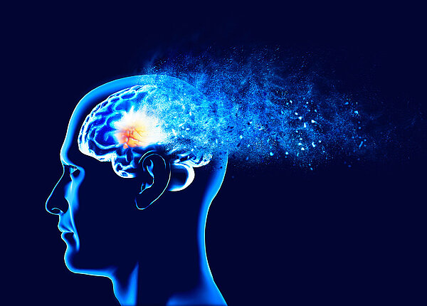 Alzheimer-Therapie mit Donanemab Graphische Darstellung eines Gehirns aus der Seitenansicht.