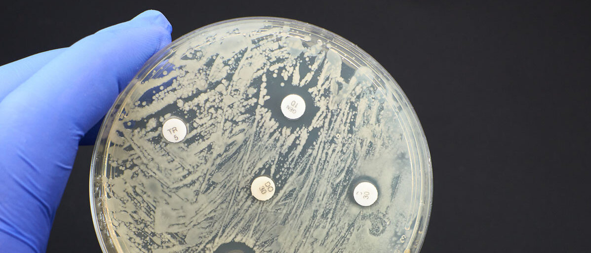Petrischale mit antimikrobiellen Resistenzen wird untersucht