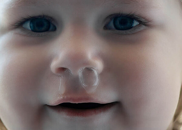 Einem Kleinkind blubbert Schnupfen aus der Nase.