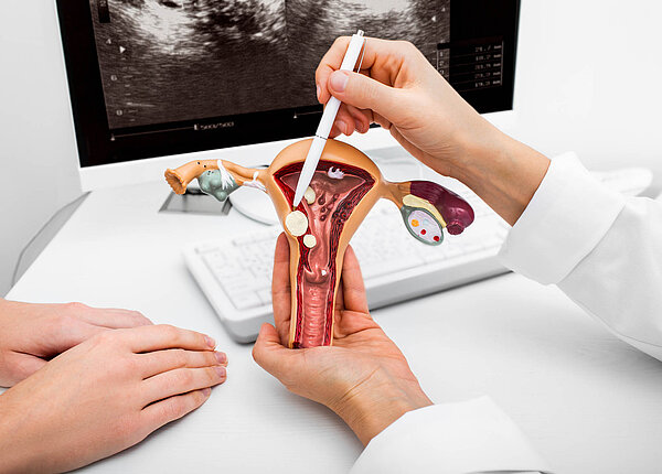 Myom, Zyste oder Polyp an der Gebärmutter: Hintergrundwisse Eine Ärztin zeigt ein Modell des Uterus und der Eierstöcke. In verschiedenen Gewebeschichten der Gebärmutter, der Eierstöcke und des Muttermunds sind kugel- oder tropfenförmige Veränderungen.