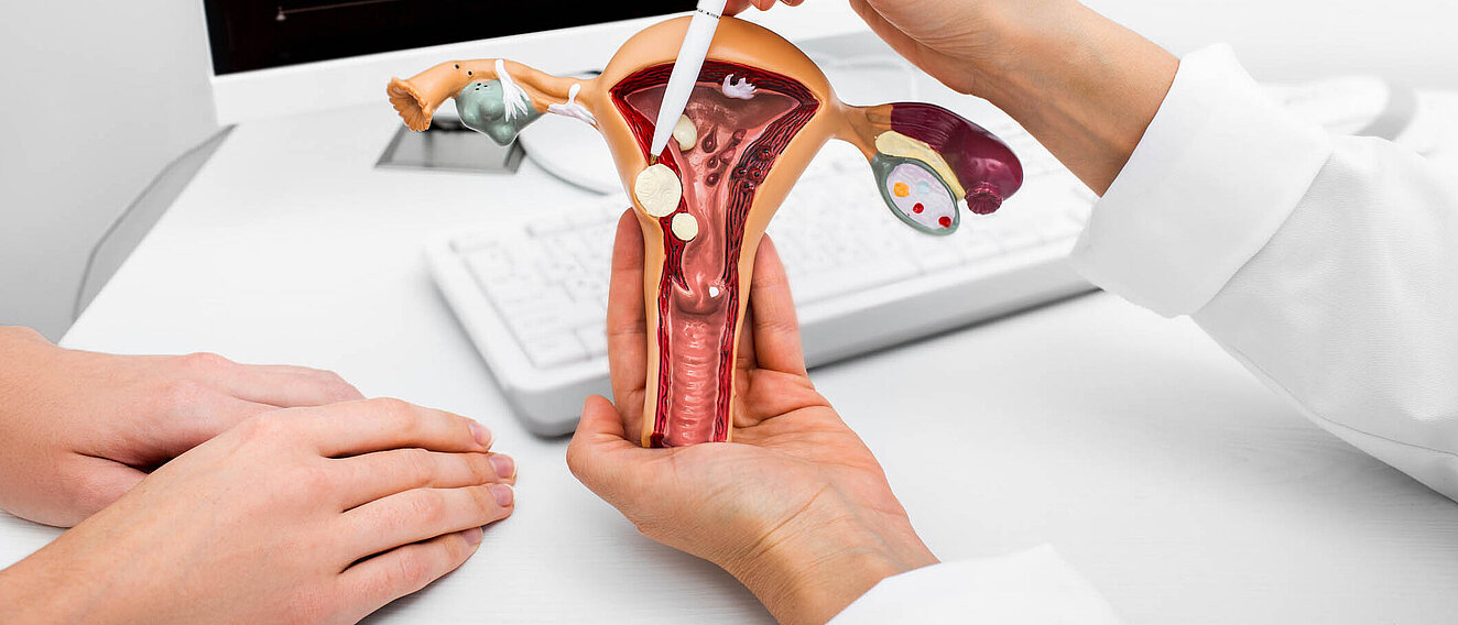 Myom, Zyste oder Polyp an der Gebärmutter: Hintergrundwisse Eine Ärztin zeigt ein Modell des Uterus und der Eierstöcke. In verschiedenen Gewebeschichten der Gebärmutter, der Eierstöcke und des Muttermunds sind kugel- oder tropfenförmige Veränderungen.