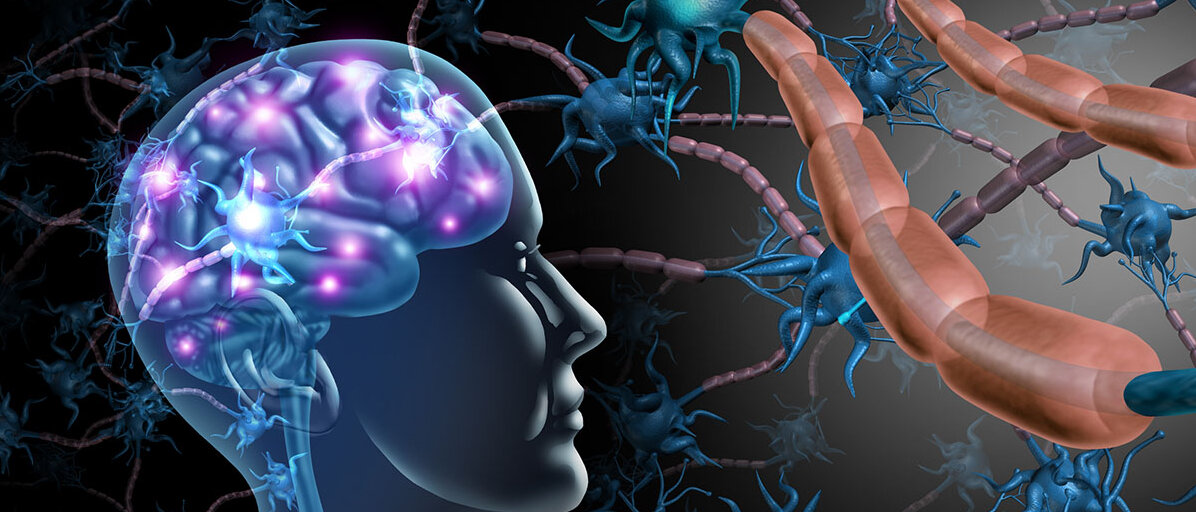 Illustration eines Kopfes, indem man die Nervenzellen des Gehirns sieht. Daneben sind einzelne Neuronen zu sehen, um deren Axone sich Myelin-Scheiden wickeln.