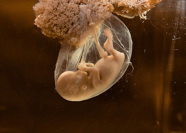 Ein ungeborenes Kind in der Fruchtblase an der Placenta