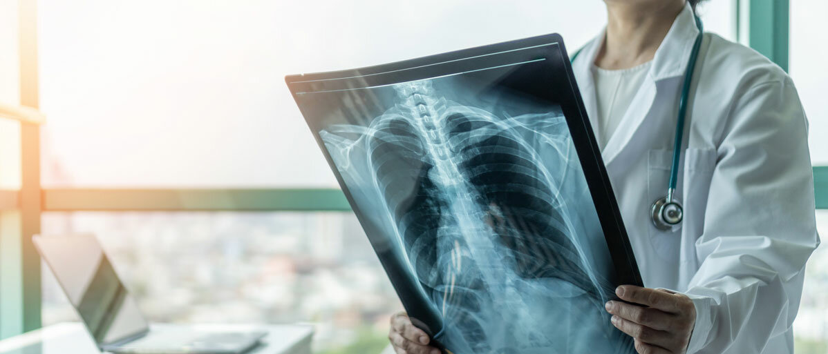 Arzt hält Röntgenbild der Atemwege in der Hand