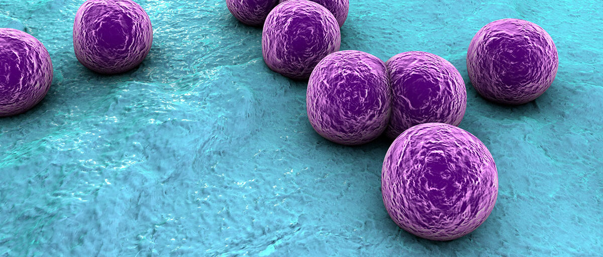 Eine Darstellung von Staphylococcus aureus auf der Hautoberfläche als violette Kugeln auf blauem Grund