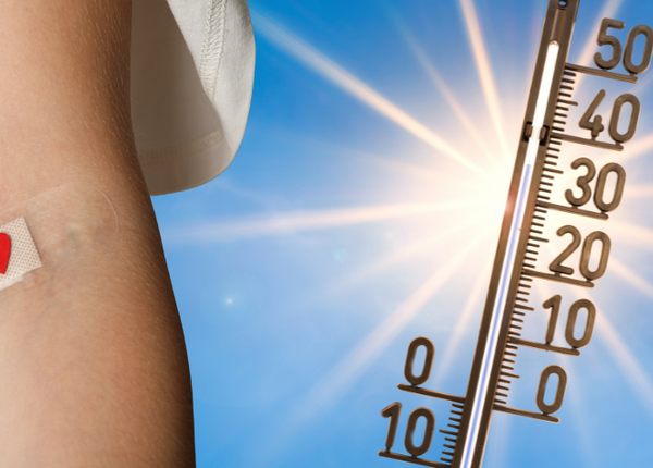 Blutspende bei Hitze Armbeuge einer Person, die Blut gespendet hat, daneben sie Sonne und ein Thermometer, dessen Anzeige in die Höhe klettert