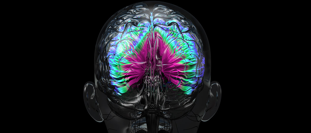 Ein MRT-Scan eines Gehirns in Farbe