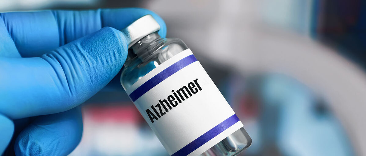 Hand mit blauem Einweghandschuh hält ein Fläschchen auf dessen weißem Etikett Alzheimer steht.