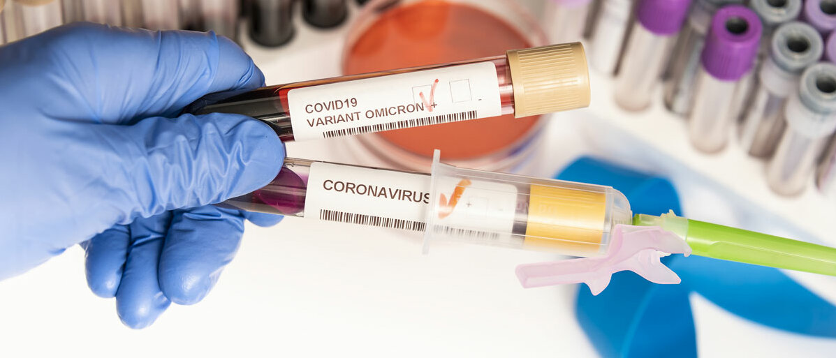 Arzt hält zwei Blutproben von Corona Tests in der Hand