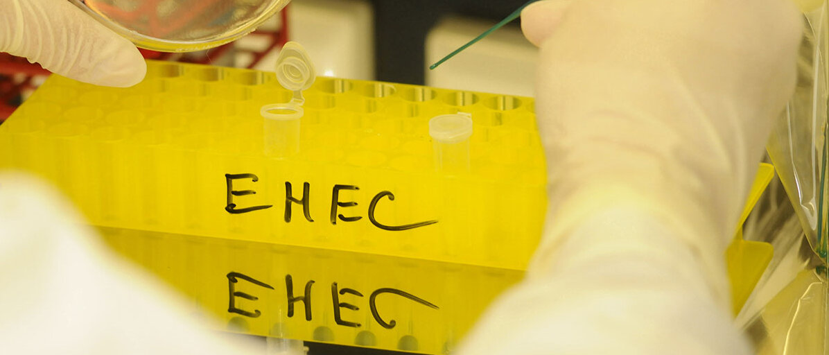 Untersuchung auf Ehec-Erreger in einem Labor für Lebensmittelkontrolle