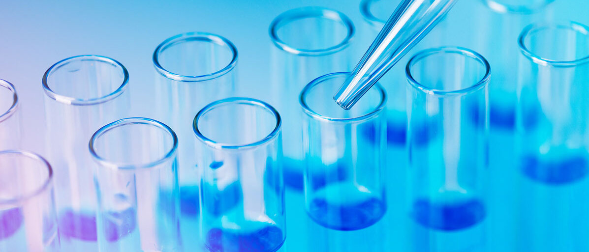 Laborproben auf blauem Hintergrund