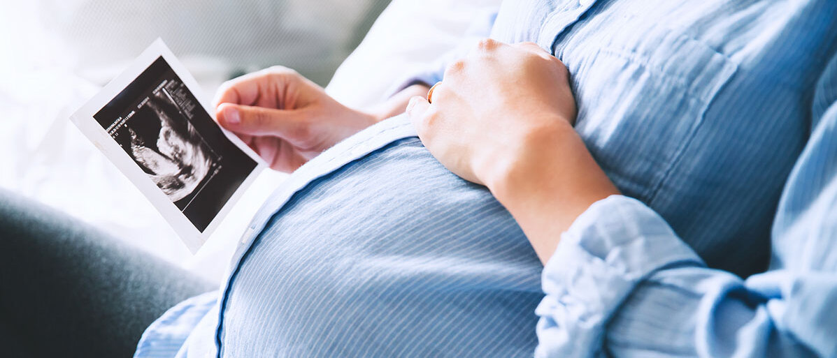 Schwangere hält Ultraschallbild in der Hand