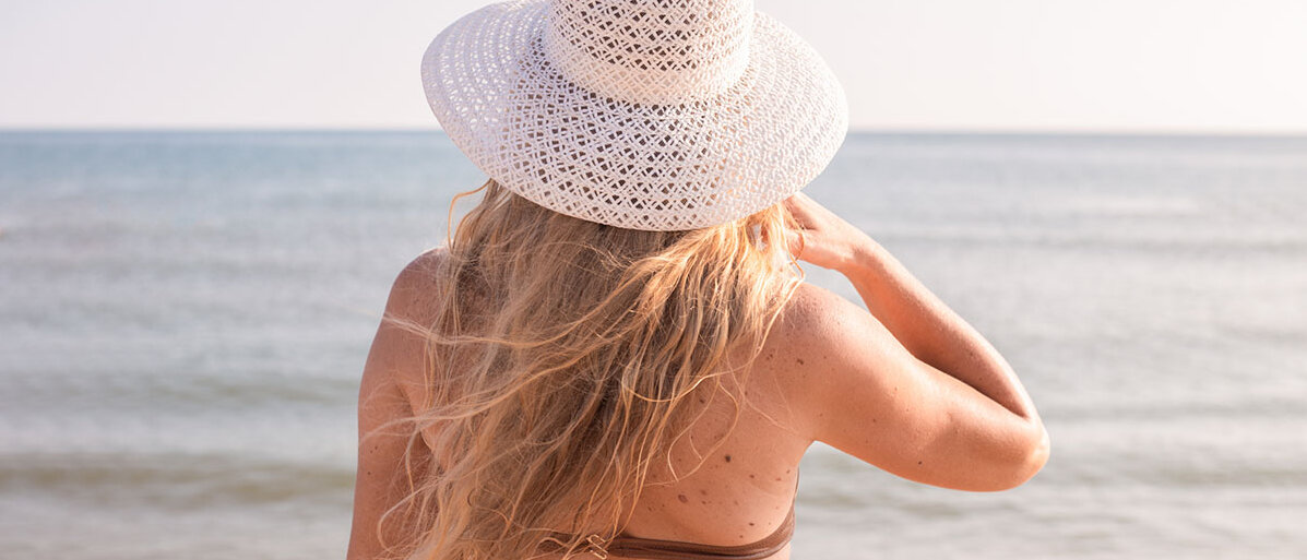 Rückenansicht einer blonden Frau mit weißem Hut und vielen Muttermalen am Strand. 
