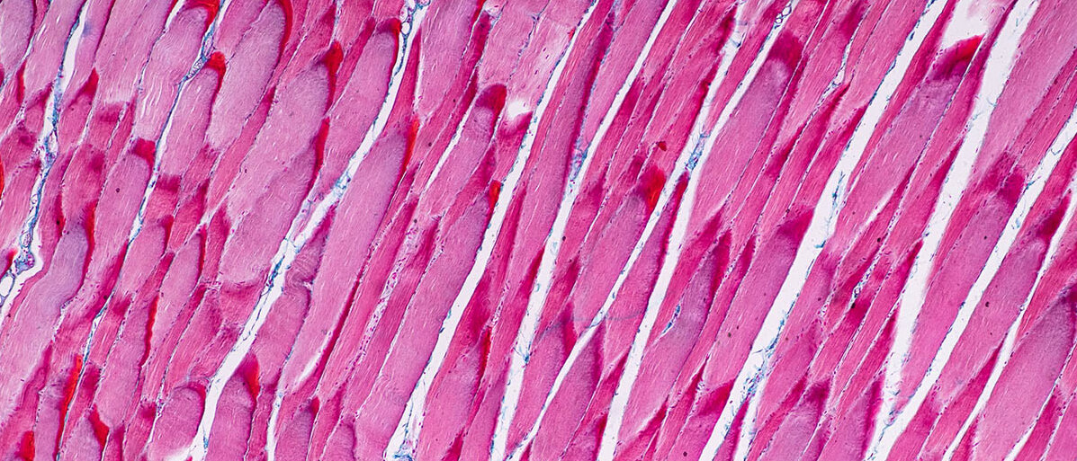 Atorvastatin und Statine generell können als Nebenwirkung Muskelschmerzen verursachen. Der Mechanismus hinter diesen Myopathien ist jetzt entschlüsselt. Mikroskopische Aufnahme der quergestreiften Muskulatur