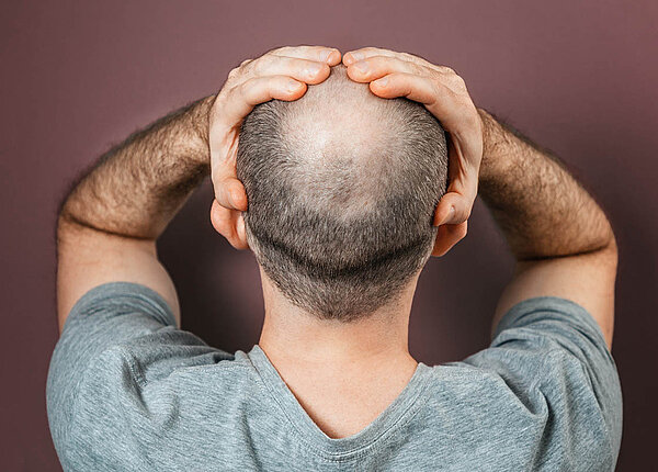 Ein Mann steht mit dem Rücken zum Betrachter. Er hat die Hände über dem Kopf zusammengeschlagen. Am Hinterkopf hat er keine Haare.