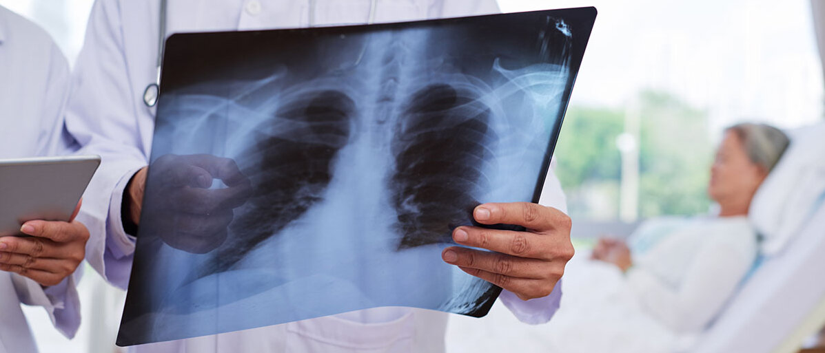 Ärzte halten Röntgenbild einer Lunge in Händen; im Hintergrund ein Patient im Krankenhausbett.