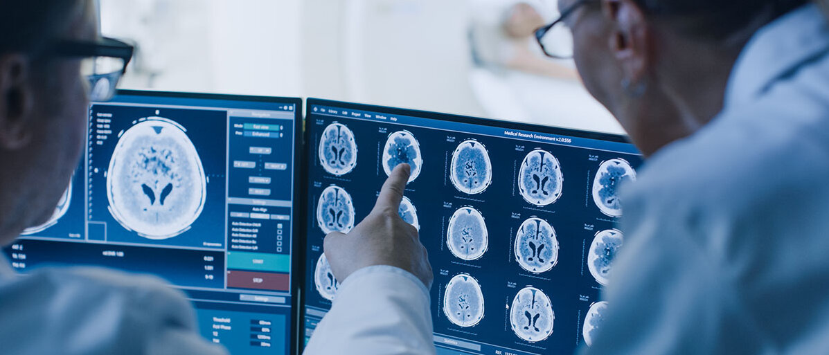 Radiologen besprechen Gehirnscans.