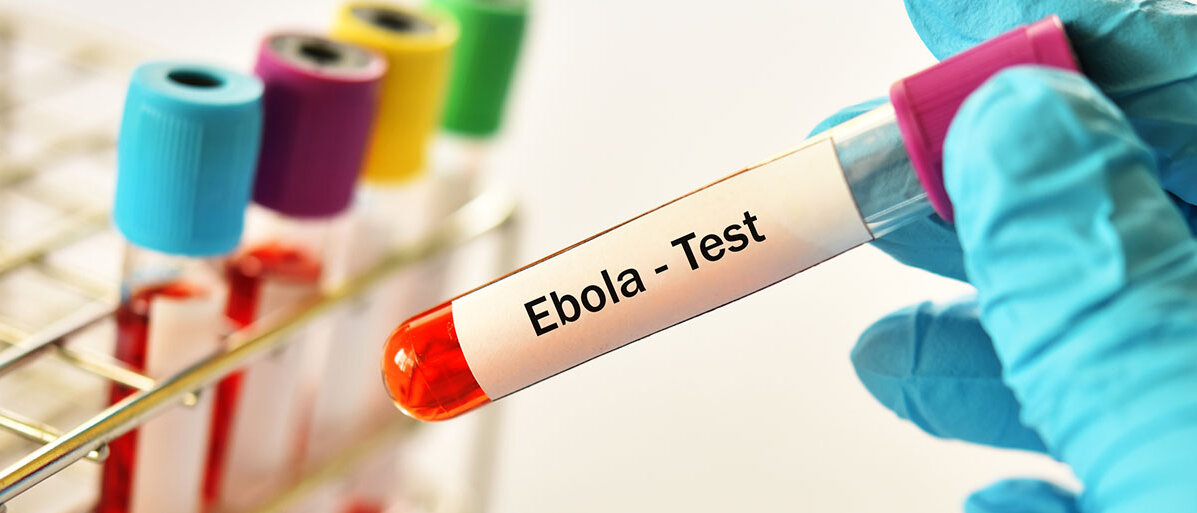 Ebola-Ausbruch im Kongo verschiedene Reagenzgläser mit Blutproben für das Ebola-Virus und eine Ärztehand hat eine Blutprobe in der Hand.