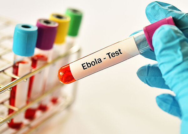 verschiedene Reagenzgläser mit Blutproben für das Ebola-Virus und eine Ärztehand hat eine Blutprobe in der Hand.