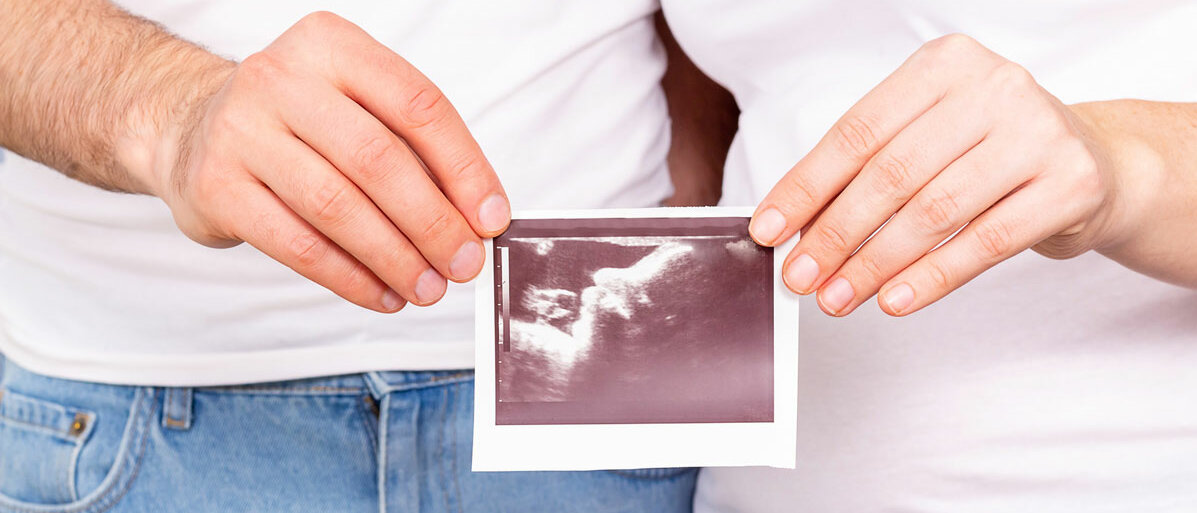 Man und Frau halten Ultraschall Foto von ihrem Baby in der Hand
