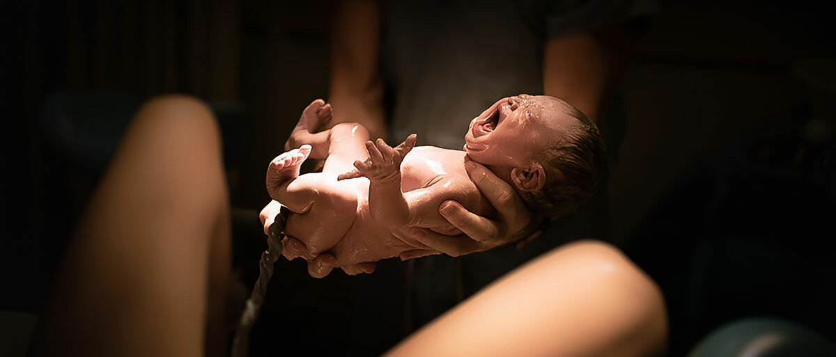 Eine Hebamme oder Ärztin hält ein neugeborenes Baby. Seine Nabelschnur führt zur Mutter, deren Beine zu erkennen sind.