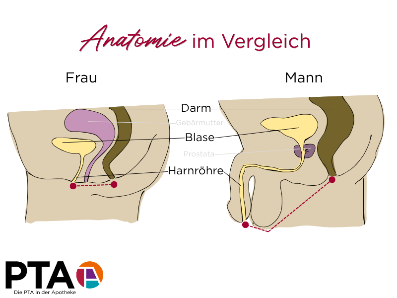 Schaubild zeigt Intimbereich von Mann und Frau in der Seitenansicht. Bei der Frau ist die Strecke zwischen Harnröhrenausgang und Darmausgang kurz, beim Mann ist die Strecke lang und wird von den Hoden blockiert.