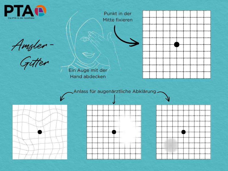 Anleitung für das Amsler-Gitter