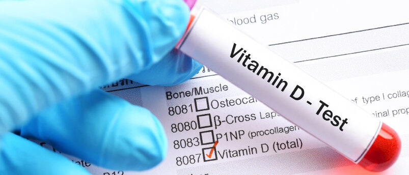 Teströhrchen Vitamin-D-Bluttest