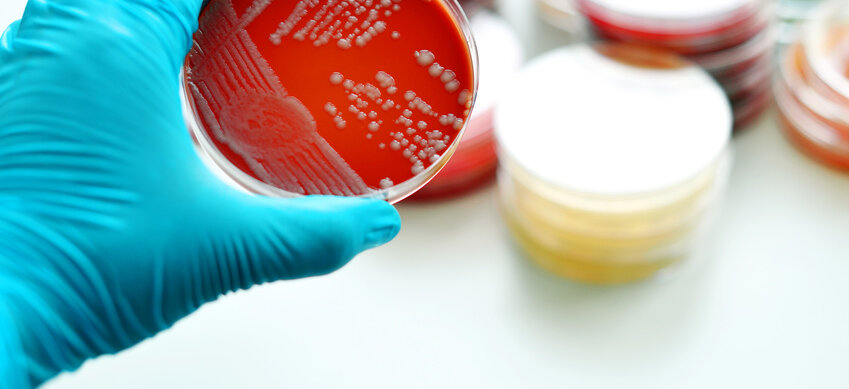 Petrischalen mit Bakterienkulturen