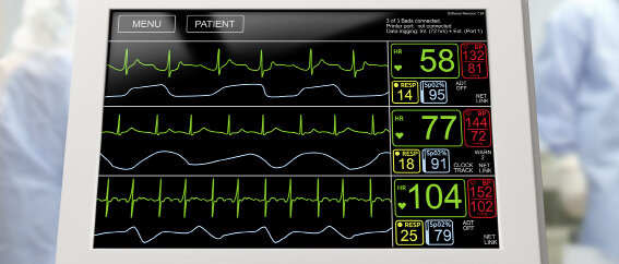 EKG-Monitor © dan_alto / iStock / Thinkstock