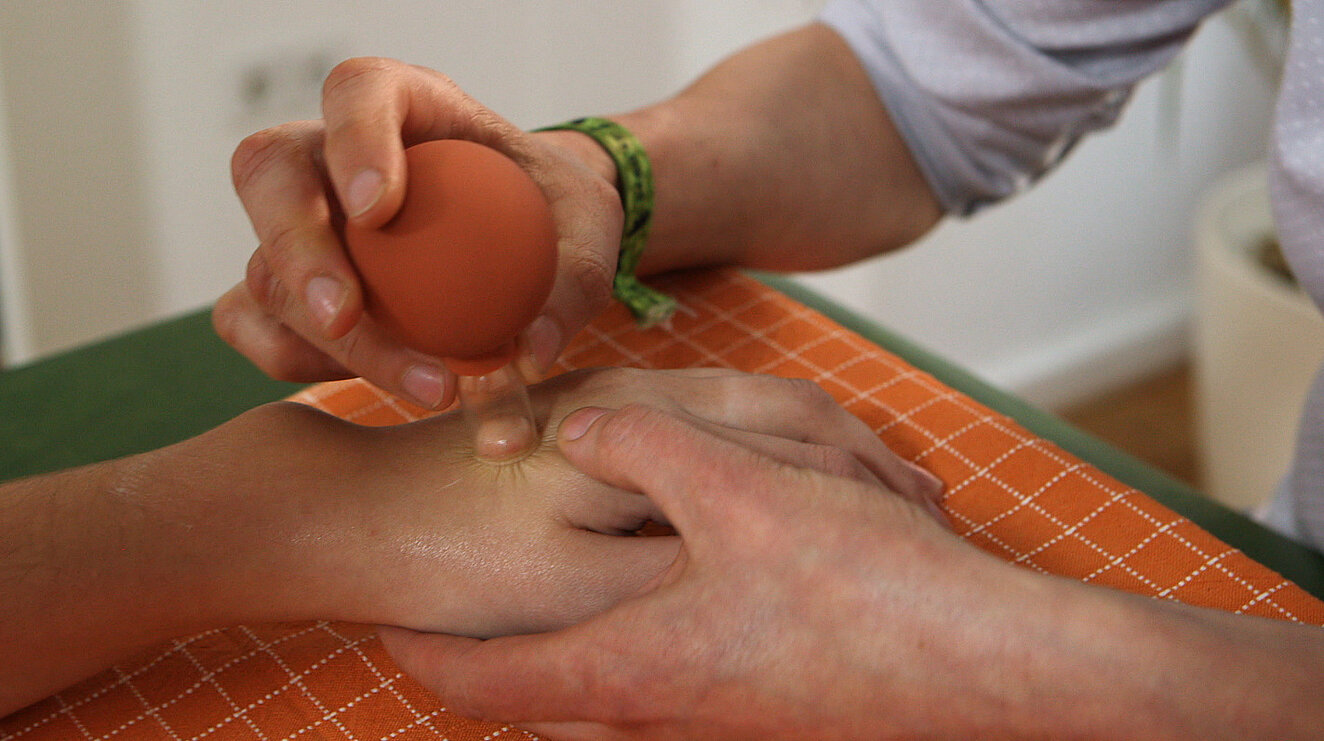 Pricktest der Haut auf allergische Reaktion