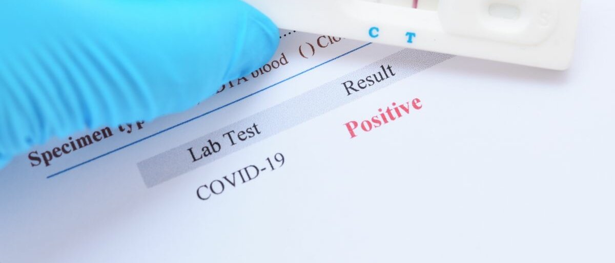 Ein Corona-Antigentest, der ein positives Ergebnis anzeigt.