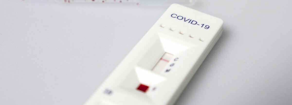 Ein Antigentest auf hellem Untergrund.