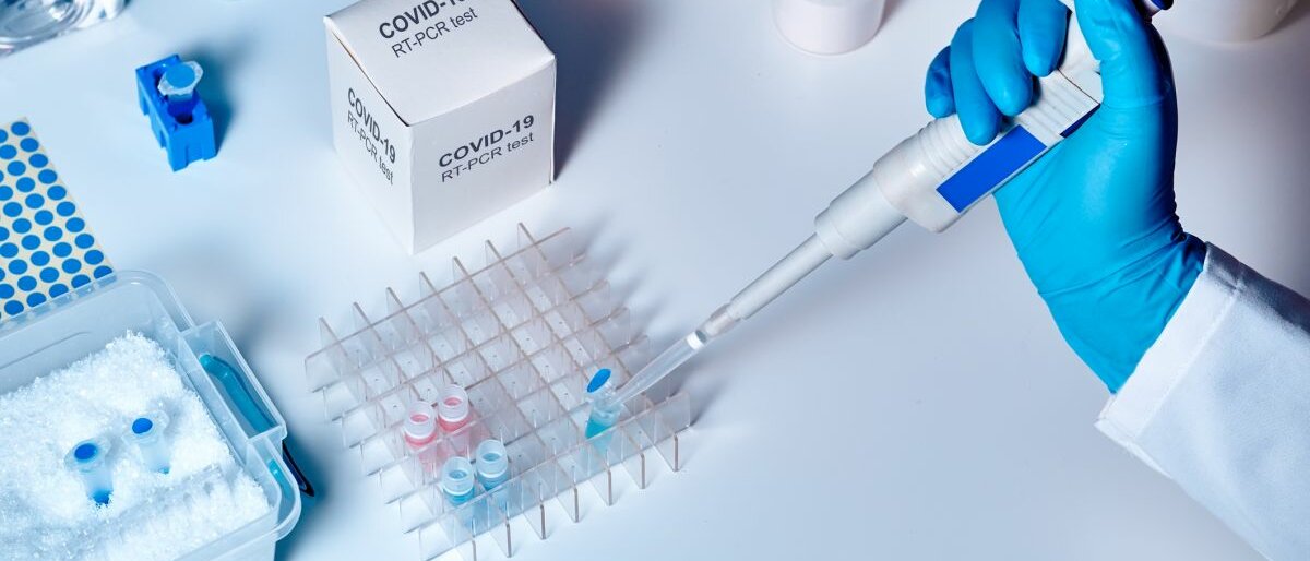 Proben werden auf Corona getestet.